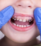 פלואוריד במים - תמונת אווירה